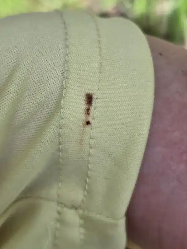 Red stain on fabric from crushed clover mite