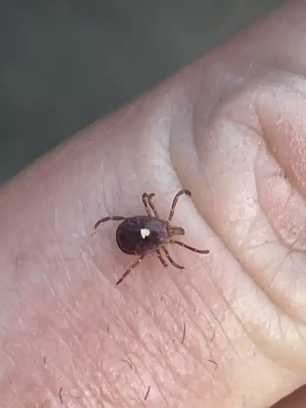 Lone star tick on human skin showing relative size