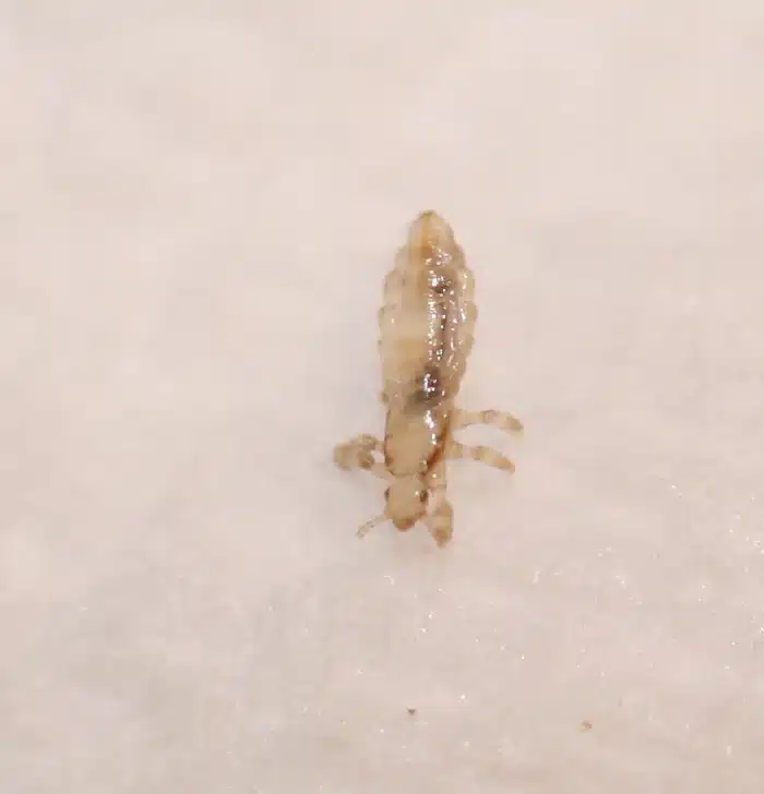Head louse showing elongated body with claws for gripping hair