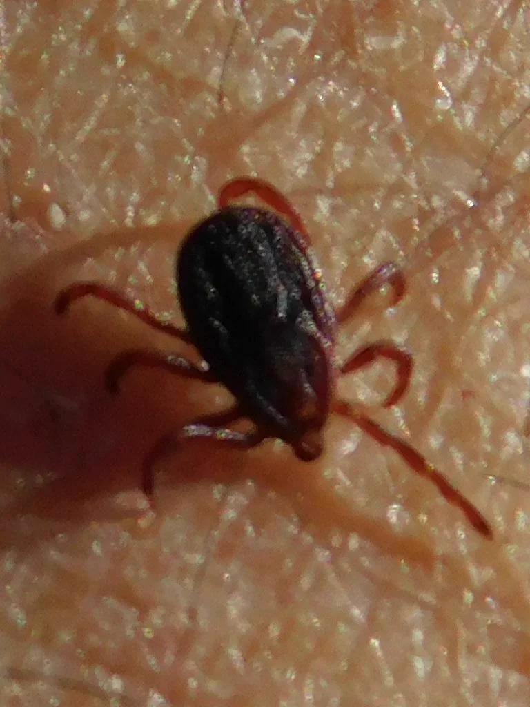Brown dog tick crawling on human skin showing its small size