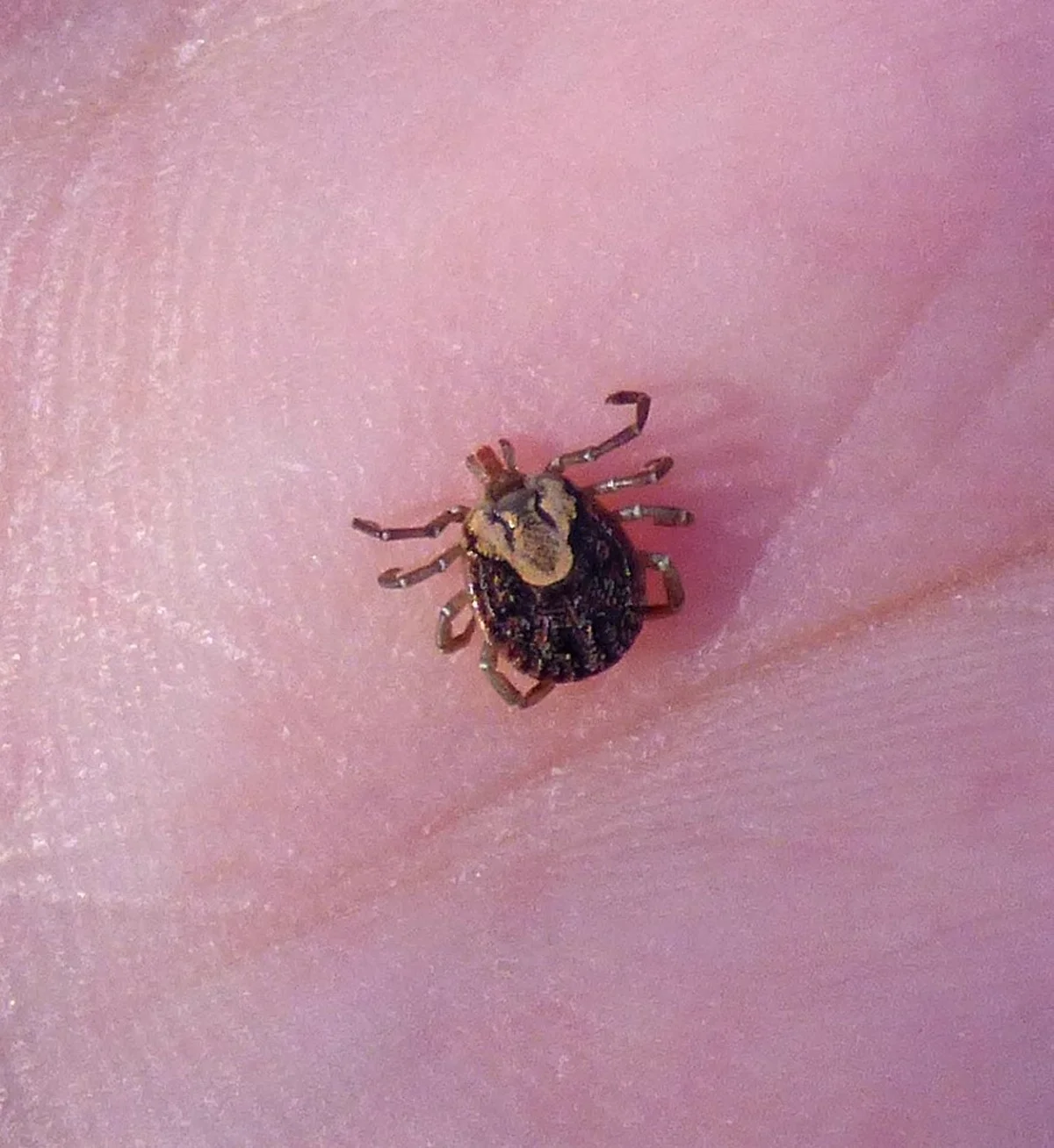 Cayenne tick on human palm for size comparison showing all eight legs