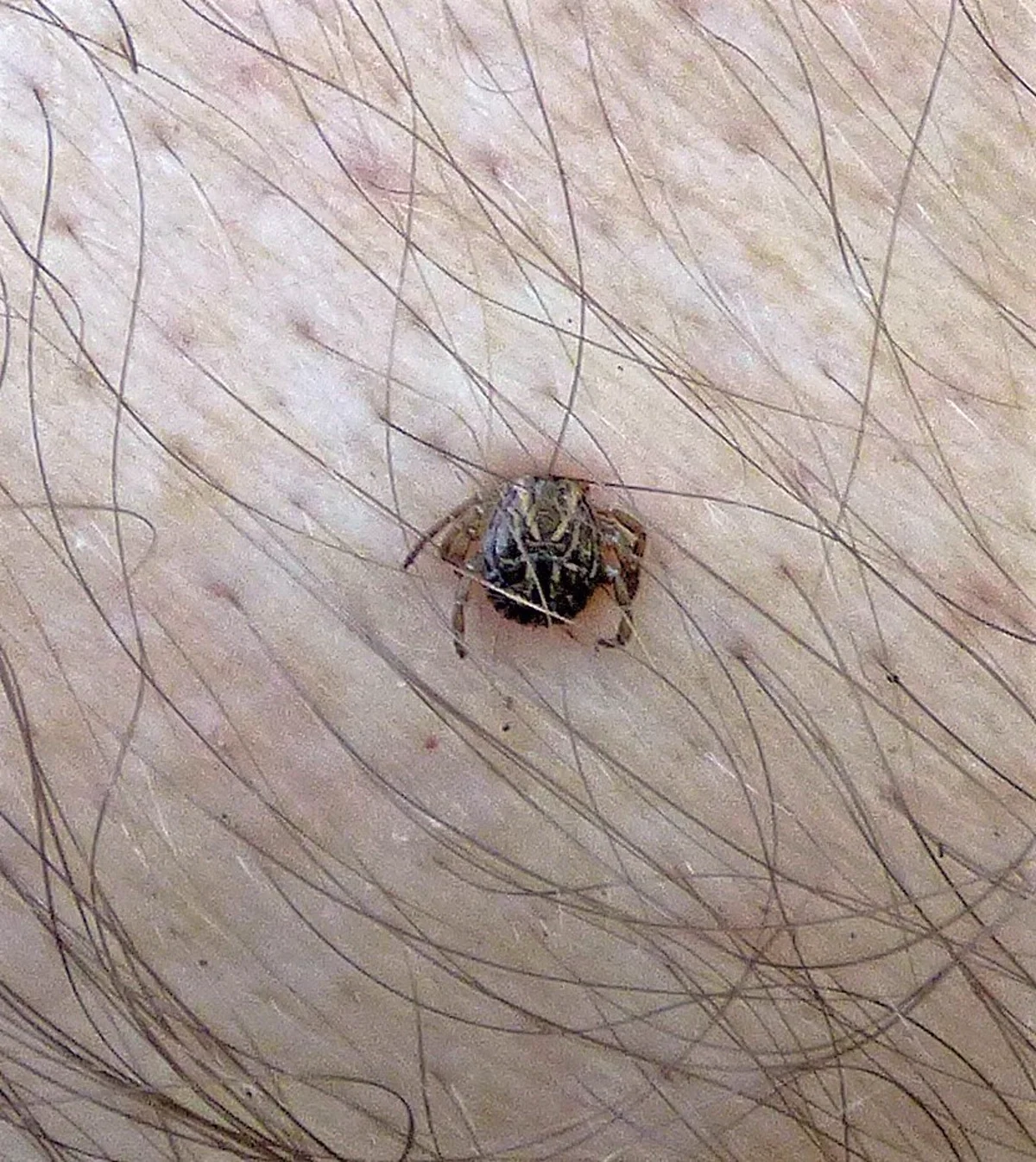Cayenne tick attached to human skin demonstrating questing behavior