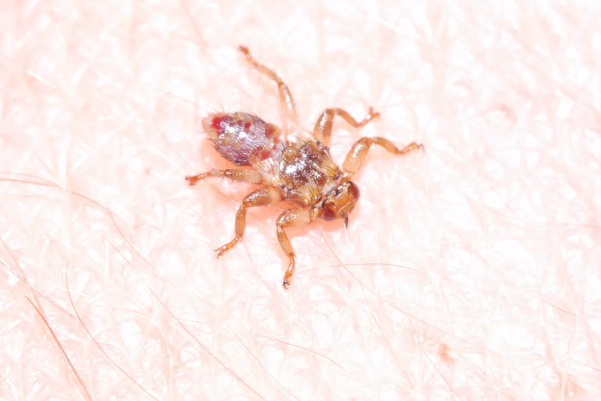 Deer ked without wings crawling on human skin showing its flat tick-like body
