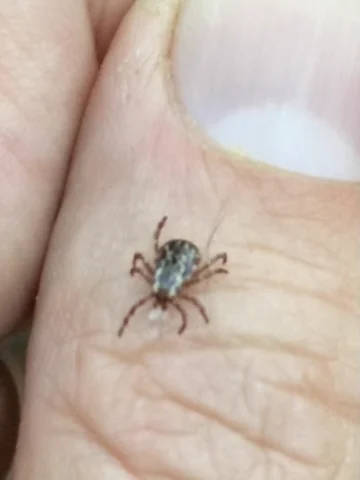 Female American dog tick on palm showing white scutum marking