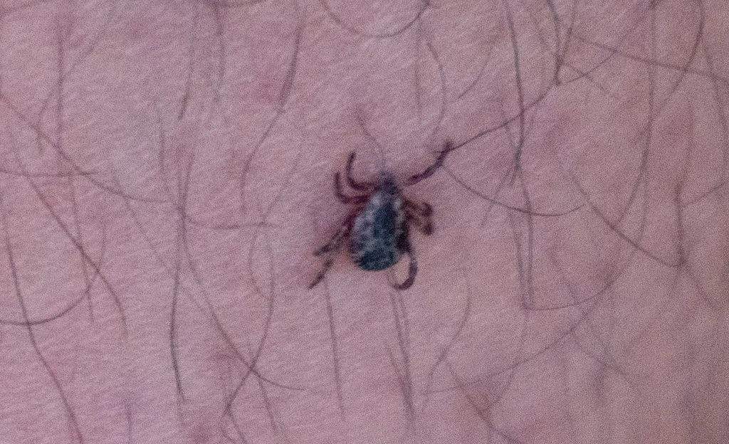 American dog tick on human arm demonstrating typical encounter