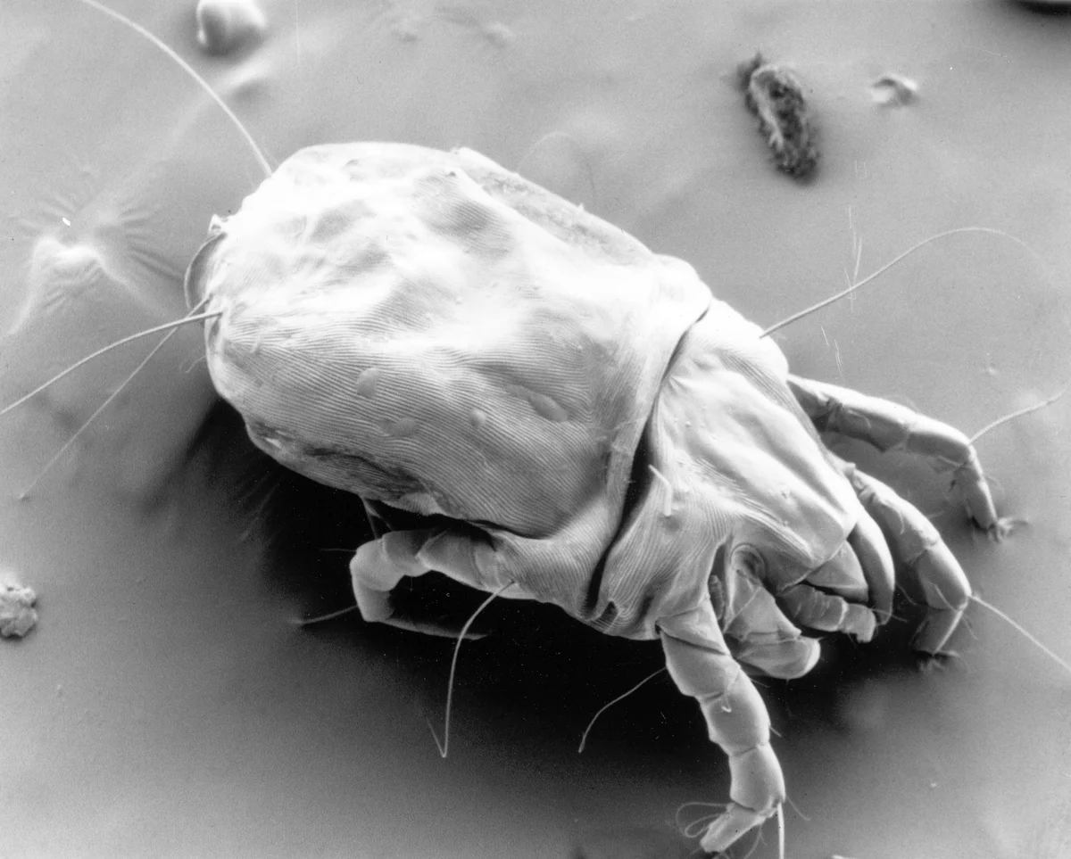Scanning electron micrograph of a female house dust mite