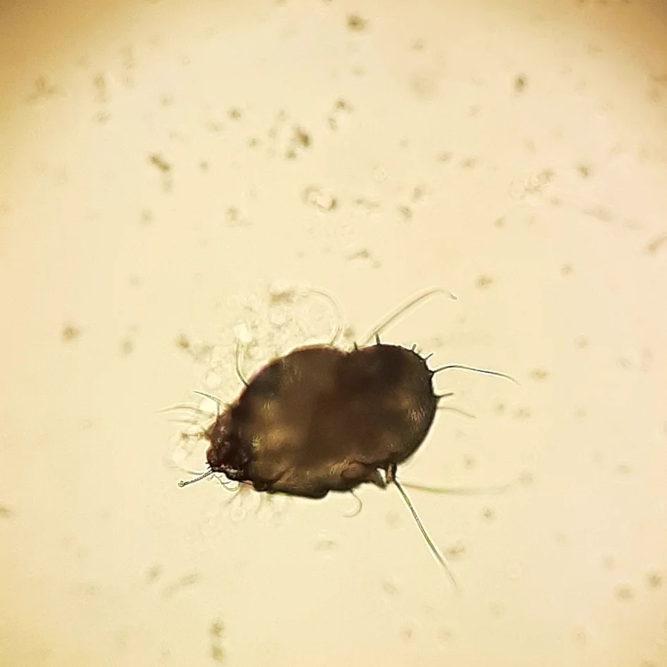 Detailed microscopic image of an ear mite