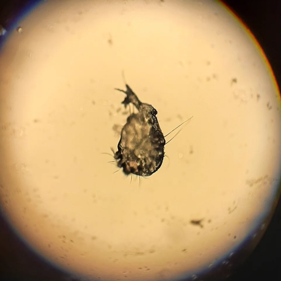 Ear mite specimen under microscope showing leg structure