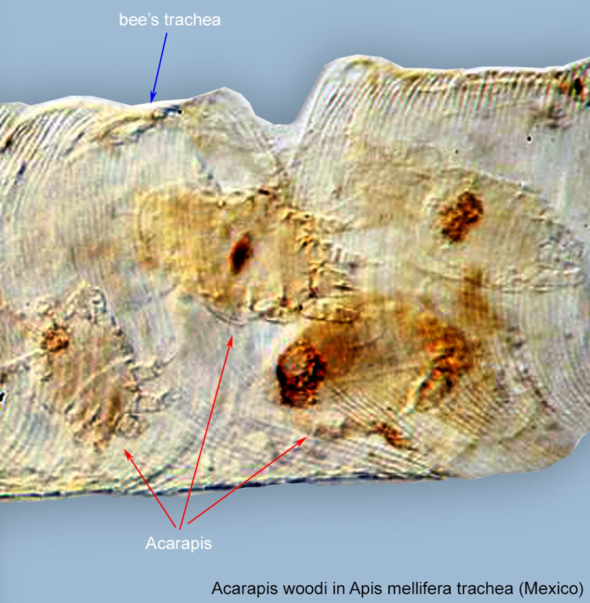 Multiple tracheal mites infesting honey bee tracheal tube showing damage and discoloration