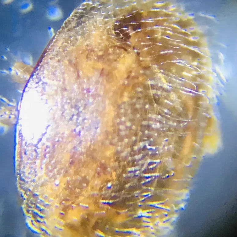 Close-up microscopic view of varroa mite showing detailed body structure